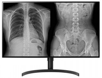 Монитор LG  LG DIAGNOSTIC MONITOR, 31.5", 8MP, 450CD/M2, DCI-P3 98%, HAS/PIVOT.